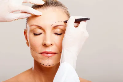 MICRONEEDLING TREATMENT